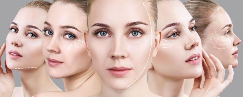 facelifts