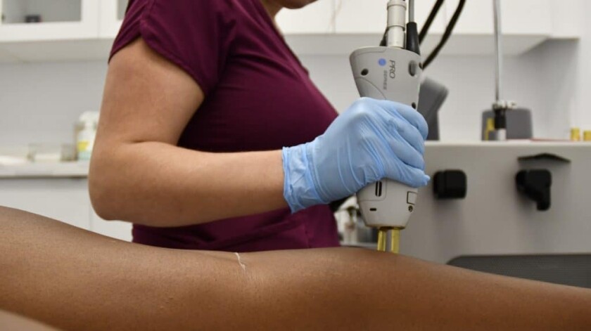 Laser hair removal content image
