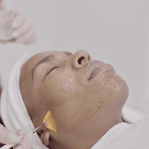 Skin treatments at Canada Medlaser Clinics
