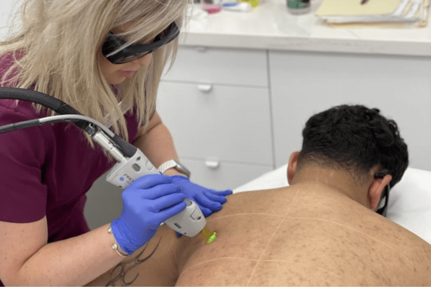 Preparing for Your First Full Body Laser Hair Removal Session Blog featured image