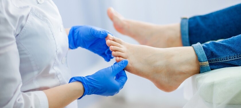 How to Treat Nail Fungus Effectively