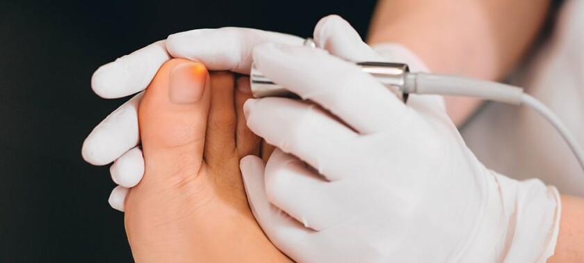 how laser toenail fungus therapy works