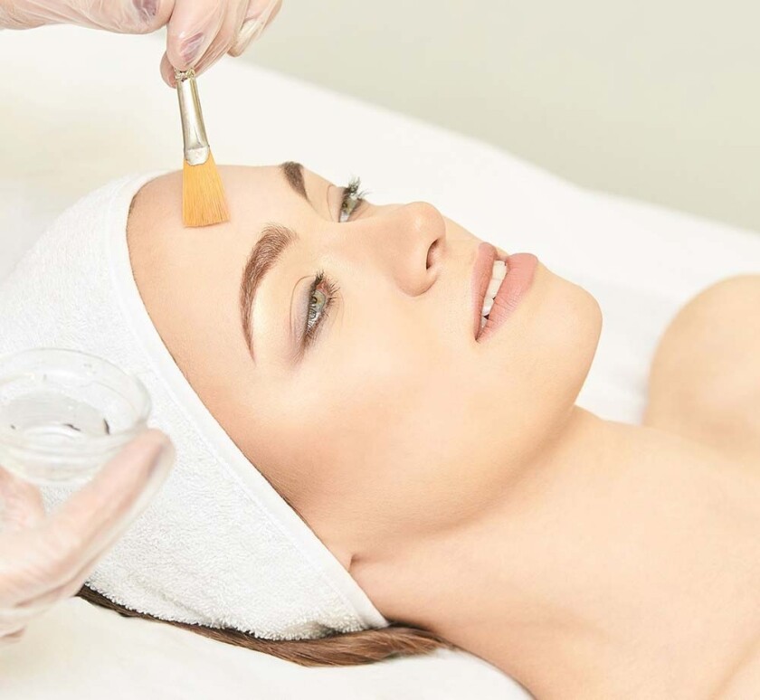 Chemical Peels