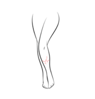 VL-FV - Leg Veins Small Area - Package of 5